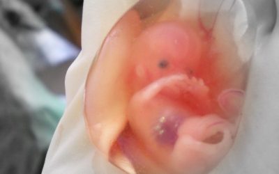 Año jubilar y aborto