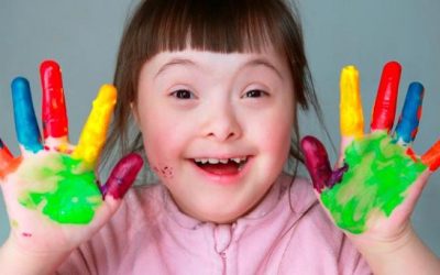 Síndrome Down, aún incomprendido