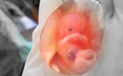 Definir es defender el tesoro de la vida